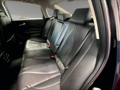 2025 Acura TLX Technology Package