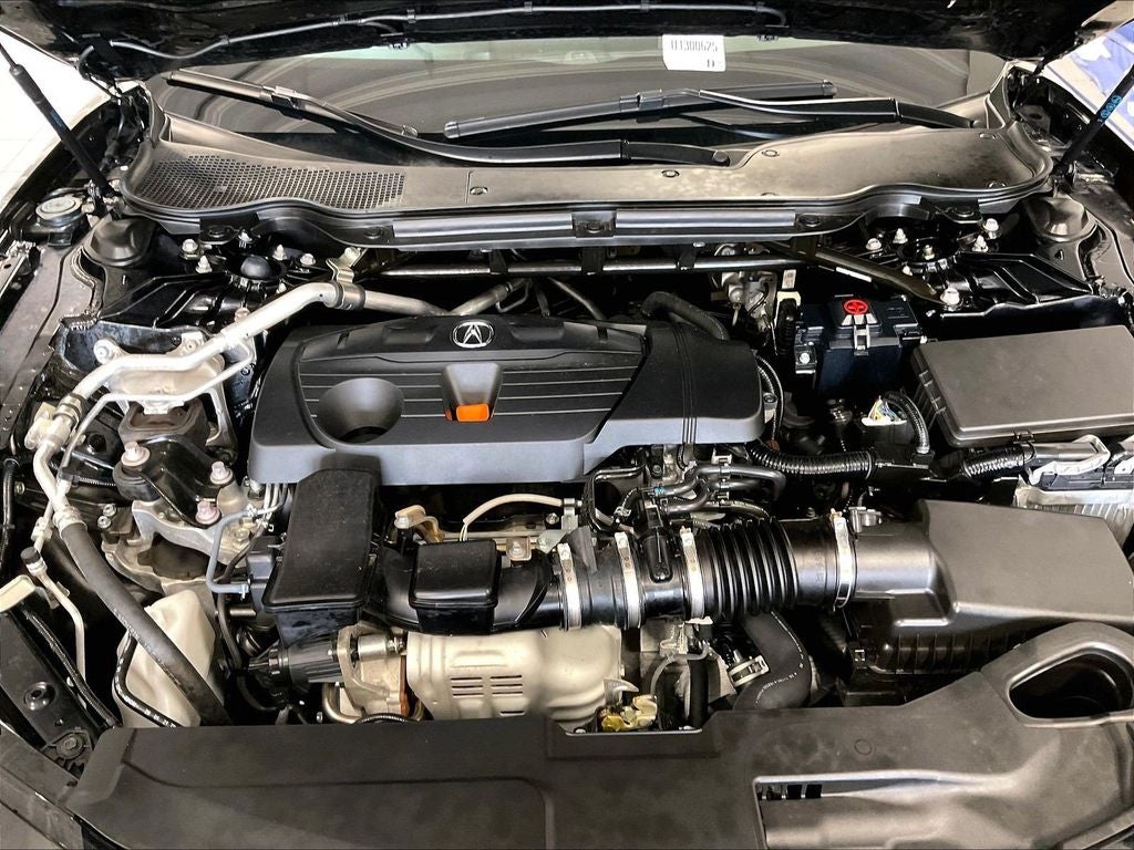 2025 Acura TLX Technology Package