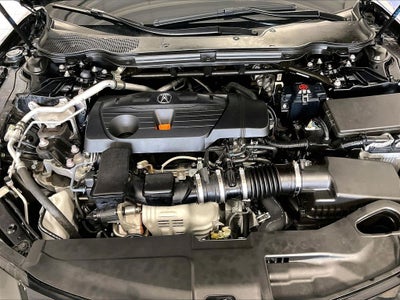 2025 Acura TLX Technology Package